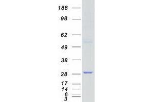 Validation with Western Blot