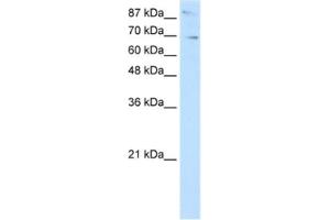 Western Blotting (WB) image for anti-SKI-Like Oncogene (SKIL) antibody (ABIN2460439) (SKIL antibody)