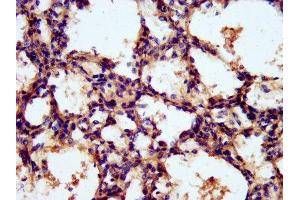 IHC image of ABIN7142118 diluted at 1:300 and staining in paraffin-embedded human lung tissue performed on a Leica BondTM system. (TNKS1BP1 antibody  (AA 271-375))