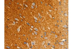 ABIN6261879 and ABIN6277946 at 1/100 staining Rat brain tissue by IHC-P. (GAP43 antibody  (C-Term))