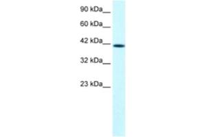Western Blotting (WB) image for anti-PTK2B Protein tyrosine Kinase 2 beta (PTK2B) antibody (ABIN2460534) (PTK2B antibody)