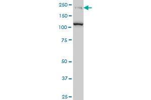 CDC42BPB monoclonal antibody (M04), clone 2D8 Western Blot analysis of CDC42BPB expression in Jurkat . (CDC42BPB antibody  (AA 1580-1679))