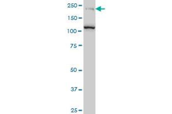 CDC42BPB antibody  (AA 1580-1679)