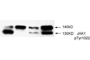 Image no. 2 for anti-Janus Kinase 1 (JAK1) (pTyr1022) antibody (ABIN196868) (JAK1 antibody  (pTyr1022))