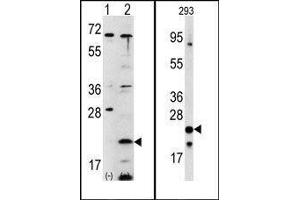 (LEFT)Western blot analysis of FXN (arrow) using rabbit polyclonal FXN Antibody (C-term). (Frataxin antibody  (C-Term))