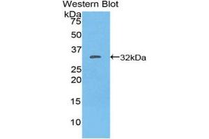 Western blot analysis of the recombinant protein. (CD103 antibody  (AA 671-917))