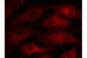 Immunofluorescence staining of methanol-fixed Hela cells using Caveolin-1(Phospho-Tyr14) Antibody. (Caveolin-1 antibody  (pTyr14))