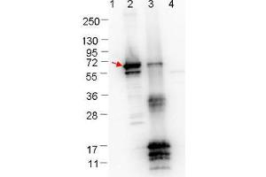 Western blot showing detection of 0. (ErpN/OspE antibody)