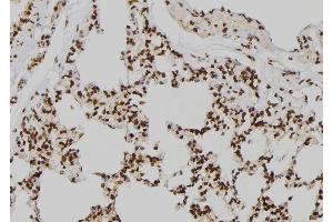ABIN6273541 at 1/100 staining Rat lung tissue by IHC-P. (JMJD2D antibody  (N-Term))