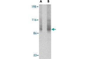Western blot analysis of TNPO3 in rat liver tissue lysate with TNPO3 polyclonal antibody  at (A) 1 and (B) 2 ug/mL .