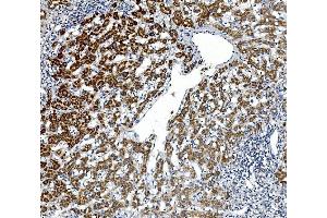 IHC analysis of Gpnmb using anti-Gpnmb antibody (ABIN7600217). (Osteoactivin antibody  (AA 164-564))