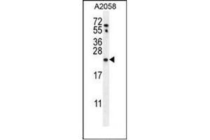 western blot analysis  of RAB10 Antibody (Center) in A2058 cell line lysates (35ug/lane). (RAB10 antibody  (Middle Region))