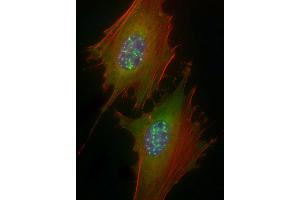 Immunofluorescent analysis of 4 % paraformaldehyde-fixed, 0. (IRAK1 antibody  (pSer376))