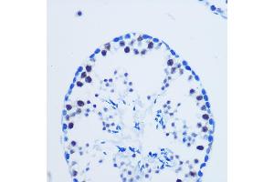Immunohistochemistry of paraffin-embedded Mouse testis using Asymmetric DiMethyl-Histone H3-R8 Rabbit pAb (ABIN3017485, ABIN3017486, ABIN3017487 and ABIN6220109) at dilution of 1:100 (40x lens). (Histone 3 antibody  (H3R8me2))