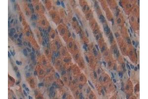 Immunohistochemistry (IHC) image for anti-Adenomatous Polyposis Coli (APC) (AA 2636-2845) antibody (ABIN7439342)