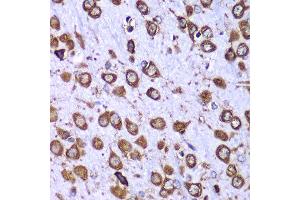 Immunohistochemistry of paraffin-embedded mouse brain using RPS10 antibody at dilution of 1:100 (x40 lens). (RPS10 antibody)