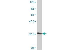 Western Blot detection against Immunogen (37 KDa) . (TNFRSF10A antibody  (AA 105-204))