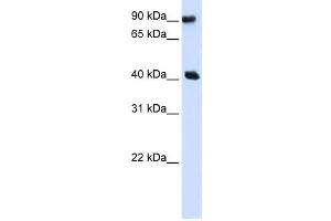 Western Blotting (WB) image for anti-Pre-B-Cell Leukemia Homeobox Interacting Protein 1 (PBXIP1) antibody (ABIN2457987) (PBXIP1 antibody)
