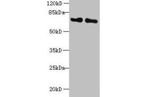 Western blot All lanes: KEAP1 antibody at 2 μg/mL Lane 1: Mouse kidney tissue Lane 2: NIH/3T3 whole cell lysate Secondary Goat polyclonal to rabbit IgG at 1/10000 dilution Predicted band size: 70 kDa Observed band size: 70 kDa (KEAP1 antibody  (AA 1-624))