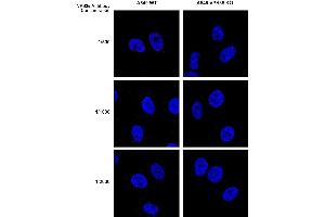 Immunocytochemistry (ICC) image for anti-Vacuolar Protein Sorting 35 (VPS35) antibody (PE) (ABIN6932954)
