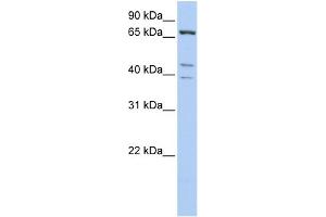 WB Suggested Anti-IPP Antibody Titration: 0. (IPP antibody  (C-Term))