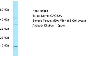 Host: RabbitTarget Name: GAGE2AAntibody Dilution: 1. (G Antigen 2A antibody  (C-Term))