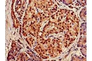 IHC image of ABIN7152317 diluted at 1:150 and staining in paraffin-embedded human pancreatic tissue performed on a Leica BondTM system. (XPO1 antibody  (AA 625-845))