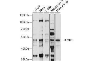 Western blot analysis of extracts of various cell lines, using UEVLD antibody (ABIN7271212) at 1:1000 dilution. (UEVLD antibody  (AA 50-190))