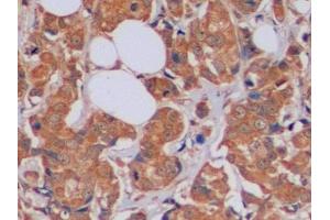 Immunohistochemistry (IHC) image for anti-Transferrin Receptor (p90, CD71) (TFRC) (AA 567-744) antibody (ABIN7433213)
