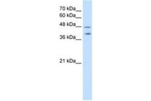 Image no. 1 for anti-Pregnancy Specific beta-1-Glycoprotein 1 (PSG1) (AA 351-400) antibody (ABIN204993)