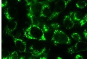 Immunofluorescence microscopy showing the detection of endogenous Bcl-rambo in HELA cells with the MAb to Bcl-rambo (human) (CT) (Rocky-2) .