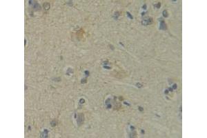 IHC-P analysis of Human Tissue, with DAB staining. (DVL3 antibody  (AA 545-716))