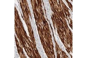 Immunohistochemical staining of human smooth muscle with TTI2 polyclonal antibody  shows strong cytoplasmic positivity at 1:20-1:50 dilution. (TTI2 antibody)