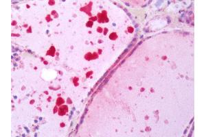 Human Thyroid: Formalin-Fixed, Paraffin-Embedded (FFPE) (TSH receptor antibody  (N-Term))