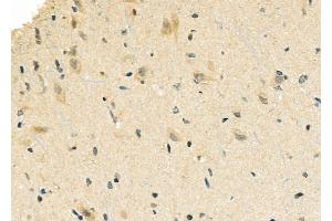 ABIN6263711 and ABIN6276848 at 1/100 staining Rat brain tissue by IHC-P.