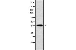 Western blot analysis of DHRS7 using Jurkat whole cell lysates (DHRS7 antibody  (C-Term))
