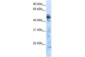 OXSM antibody used at 1 ug/ml to detect target protein. (OXSM antibody  (Middle Region))