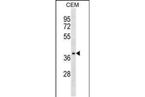 Western blot analysis in CEM cell line lysates (35ug/lane). (NDRG4 antibody  (AA 193-220))