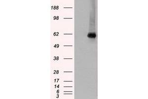 HEK293T cells were transfected with the pCMV6-ENTRY control (Left lane) or pCMV6-ENTRY CHEK2 (Right lane) cDNA for 48 hrs and lysed. (CHEK2 antibody)