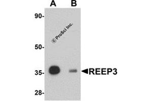 Western Blotting (WB) image for anti-Receptor Accessory Protein 3 (REEP3) (C-Term) antibody (ABIN1030616) (REEP3 antibody  (C-Term))