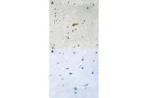 Immunohistochemical staining of human brain tissue by FRS2 (phospho Y436) polyclonal antibody  without blocking peptide (A) or preincubated with blocking peptide (B) under 1:50-1:100 dilution.