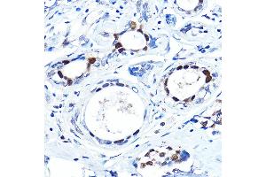 Immunohistochemistry (IHC) image for anti-Forkhead Box A1 (FOXA1) (AA 263-472) antibody (ABIN7267231)