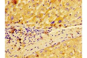IHC image of ABIN7159558 diluted at 1:100 and staining in paraffin-embedded human liver tissue performed on a Leica BondTM system. (MACC1 antibody  (AA 371-514))