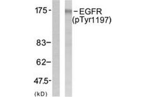 Western blot analysis of extracts from A431 cells treated with EGF 40 muM 10', using EGFR (Phospho-Tyr1197) Antibody. (EGFR antibody  (pTyr1197))
