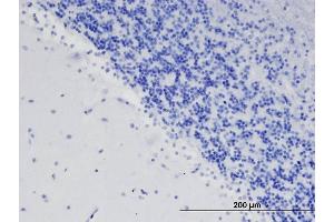 ABIN2564272 (1. (TENM3 antibody  (Internal Region))