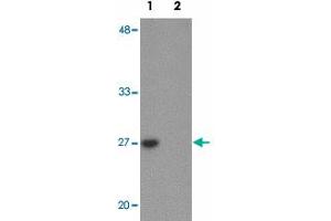 Western blot analysis of TMEM59 in human kidney tissue lysate with TMEM59 polyclonal antibody  at 1 ug/mL in (1) the absence and (2) the presence of blocking peptide. (TMEM59 antibody  (N-Term))