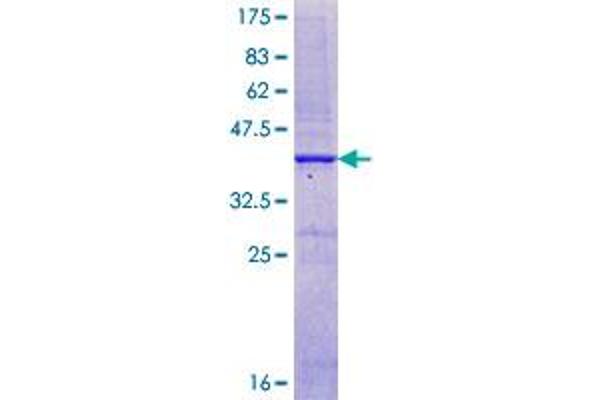 CASR Protein (AA 21-130) (GST tag)