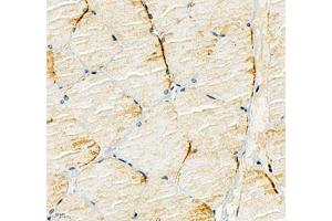Immunohistochemistry of paraffin embedded rat Skeletal muscle using Kcnh5 (ABIN7075159) at dilution of 1:200 (400x lens) (KCNH5 antibody)