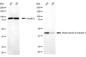 anti-serpin Peptidase Inhibitor, Clade B (Ovalbumin), Member 1 (SERPINB1) antibody