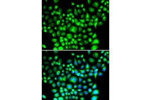 Immunofluorescence analysis of U2OS cells using BCAP31 antibody. (BCAP31 antibody  (AA 127-246))